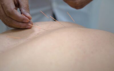 Unlocking Better Sleep with Chinese Medicine – How Acupuncture and Herbal Remedies Can Help Tackle Insomnia